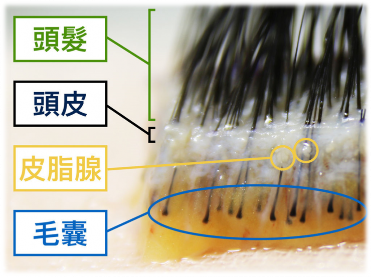 頭髮至毛囊圖.png